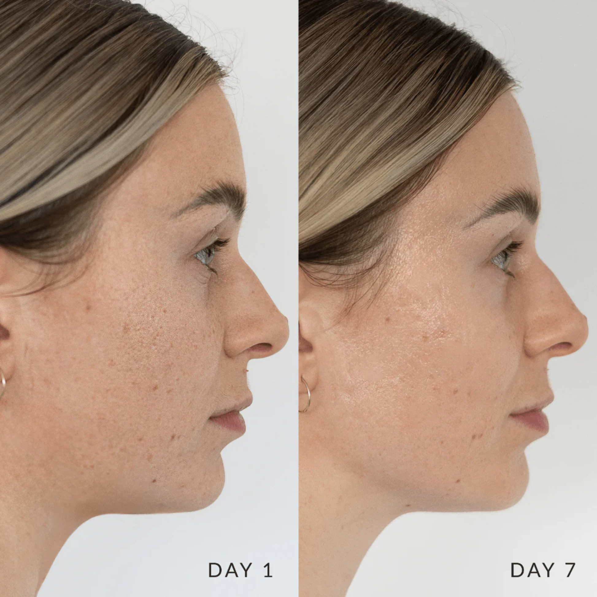 Side-by-side Glory Cream comparison of a woman's face labeled 'Day 1' and 'Day 7' on a white background.