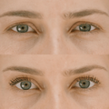 Close-up of a person's eyes with a Eco by Sonya Driver Mitzi Mascara before and after comparison.