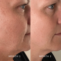 Side-by-side comparison of a person's face with and without visible aging signs.