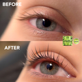 Before and after comparison of an eye with KiwiFix product application.